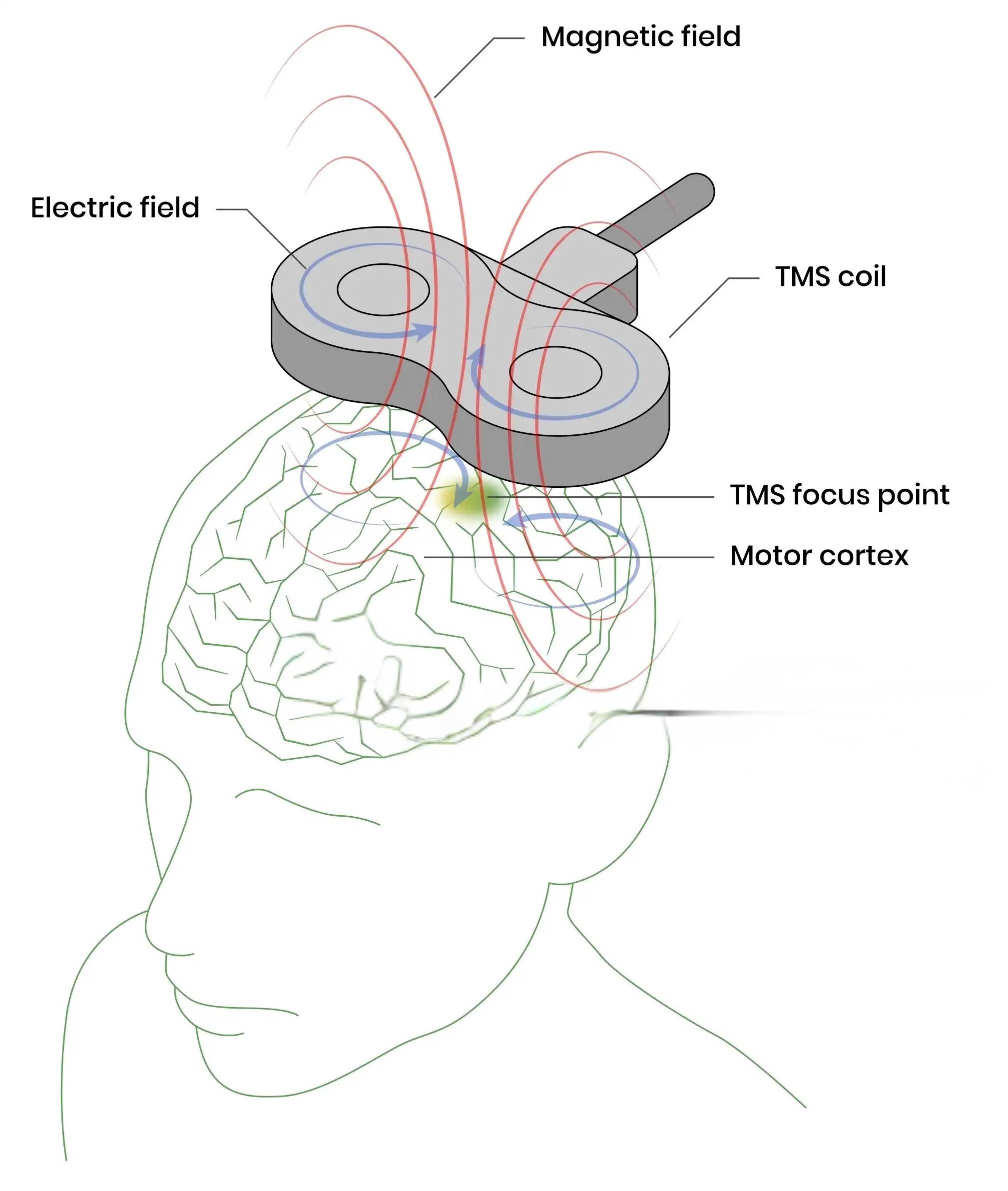 TMS mechanism